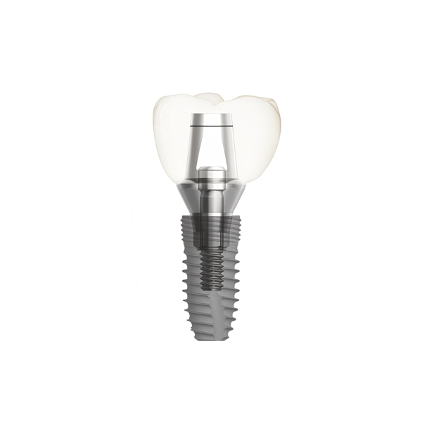 Personalized Dental Abutment and Screw