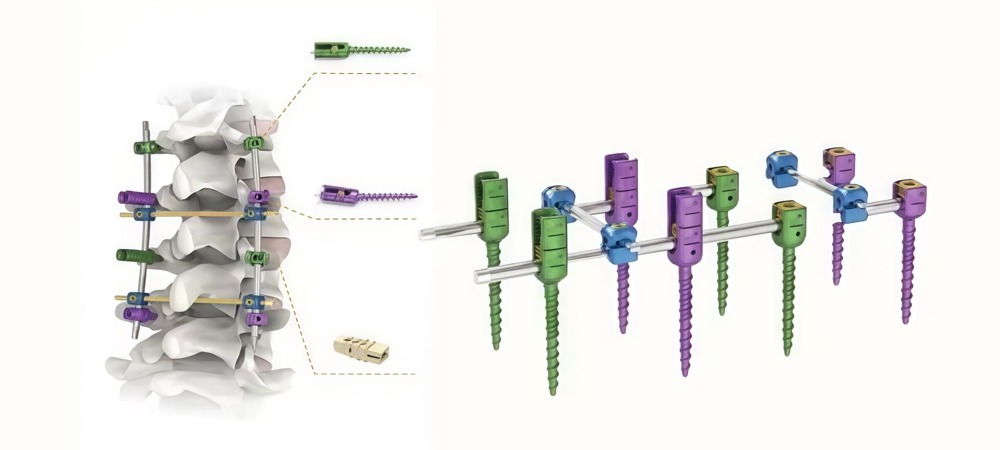 Pedicle Screw Systems