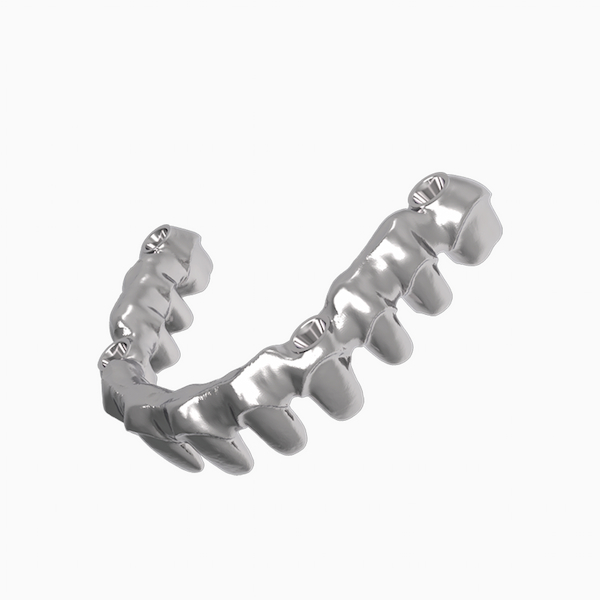 Personalized Abutment Crown and Bridge