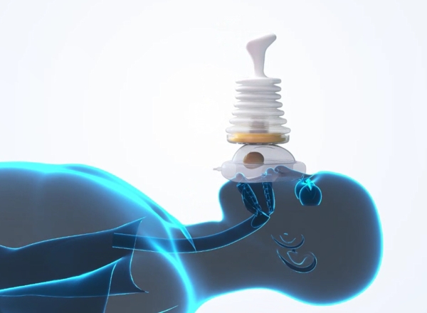 How Anti Choking Device Works
